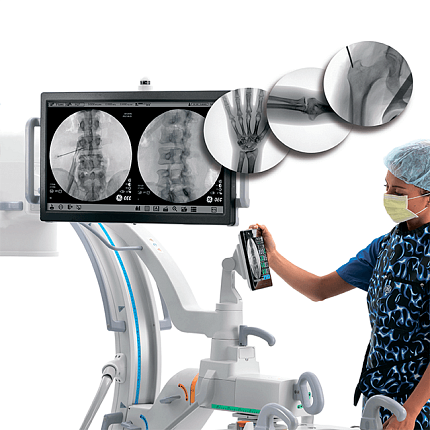 Купить Мобильный рентгеновский аппарат с С-дугой GE OEC One CFD | Изображение 2 - миниатюра