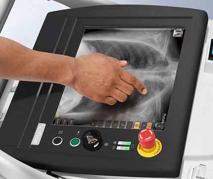 Купить Цифровой передвижной рентгеновский аппарат Philips MobileDiagnost wDR | Изображение 4 - миниатюра