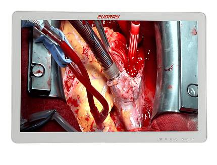 Купить Монитор 32" Full HD эндоскопический-хирургический EVORAY S3221P - миниатюра