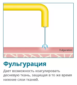 Купить Электрокоагулятор Servotome | Изображение 5