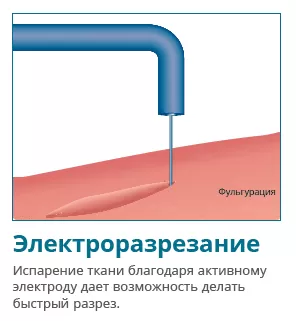 Купить Электрокоагулятор Servotome | Изображение 4