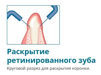 Купить Электрокоагулятор Servotome | Изображение 10