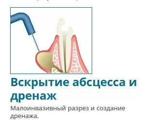 Купить Электрокоагулятор Servotome | Изображение 9