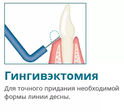 Купить Электрокоагулятор Servotome | Изображение 8