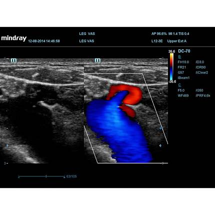 Купить Экспертный ультразвуковой аппарат Mindray DC-70 Pro X-Insight | Изображение 7 - миниатюра