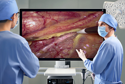 Купить Видеоэндоскопическая система Mindray HyPixel U1 | Изображение 5