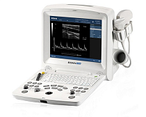 картинка УЗИ аппарат Edan Dus 60 от магазин кислородного оборудования, Екатеринбург / компания Бравокислород