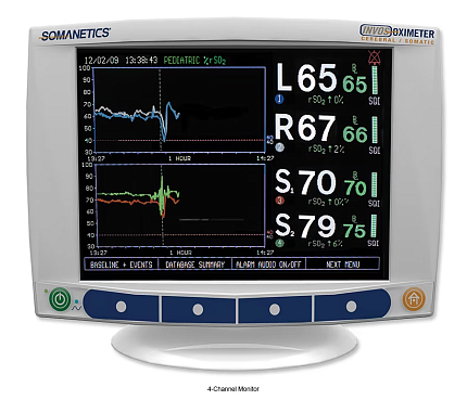 Купить Церебральный/соматический оксиметр Medtronic Invos 5100C | Изображение 2