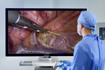 Купить Видеоэндоскопическая система Mindray HyPixel U1 | Изображение 4