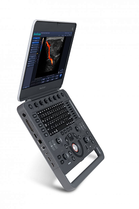 Купить Ультразвуковой аппарат SonoScape S2N Vet | Изображение 2 - миниатюра