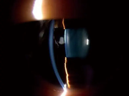 Купить Видеокамера Topcon DC-4 для щелевой лампы | Изображение 3