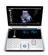 картинка УЗИ аппарат Vinno 5 от магазин кислородного оборудования, Екатеринбург / компания Бравокислород
