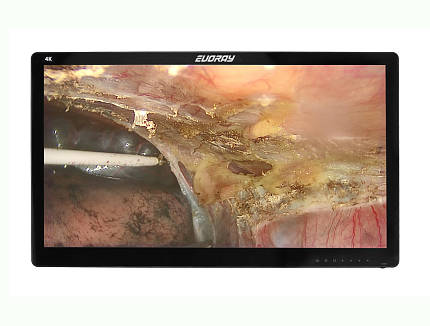 Купить Монитор 27” 4K эндоскопический-хирургический EVORAY S2785P | Изображение 5