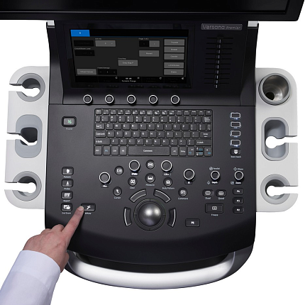Купить Ультразвуковая система диагностики GE Versana Premier Platinum | Изображение 2 - миниатюра