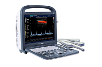картинка Ультразвуковой аппарат SonoScape S2 от магазин кислородного оборудования, Екатеринбург / компания Бравокислород