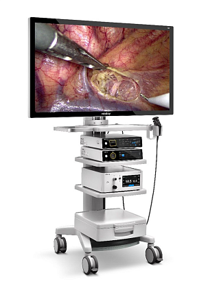 Купить Видеоэндоскопическая система Mindray HyPixel U1 | Изображение 2