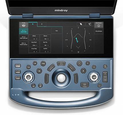 Купить Ультразвуковая система Mindray MX7 | Изображение 2 - миниатюра
